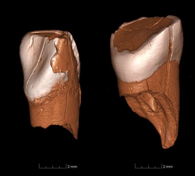 3D models of the two teeth. (Daniele Panetta, CNR Institute of Clinical Physiology)